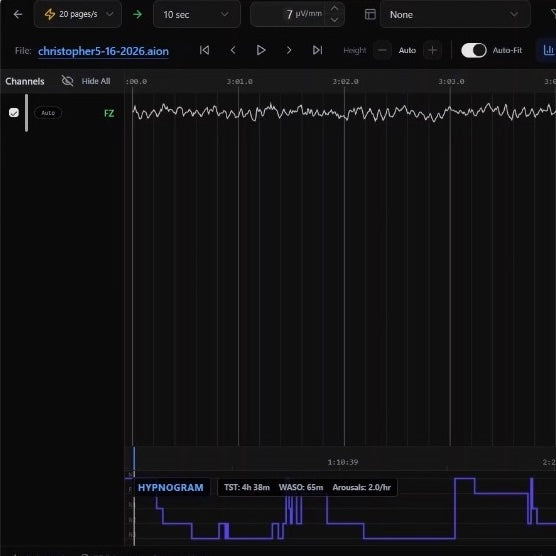 Personal EEG