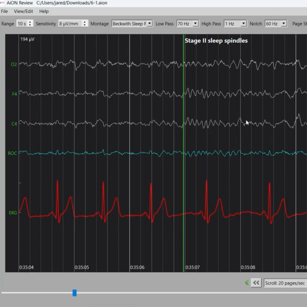 AiON EEG Kit | Brain-Controlled Gaming & Sleep Tracking