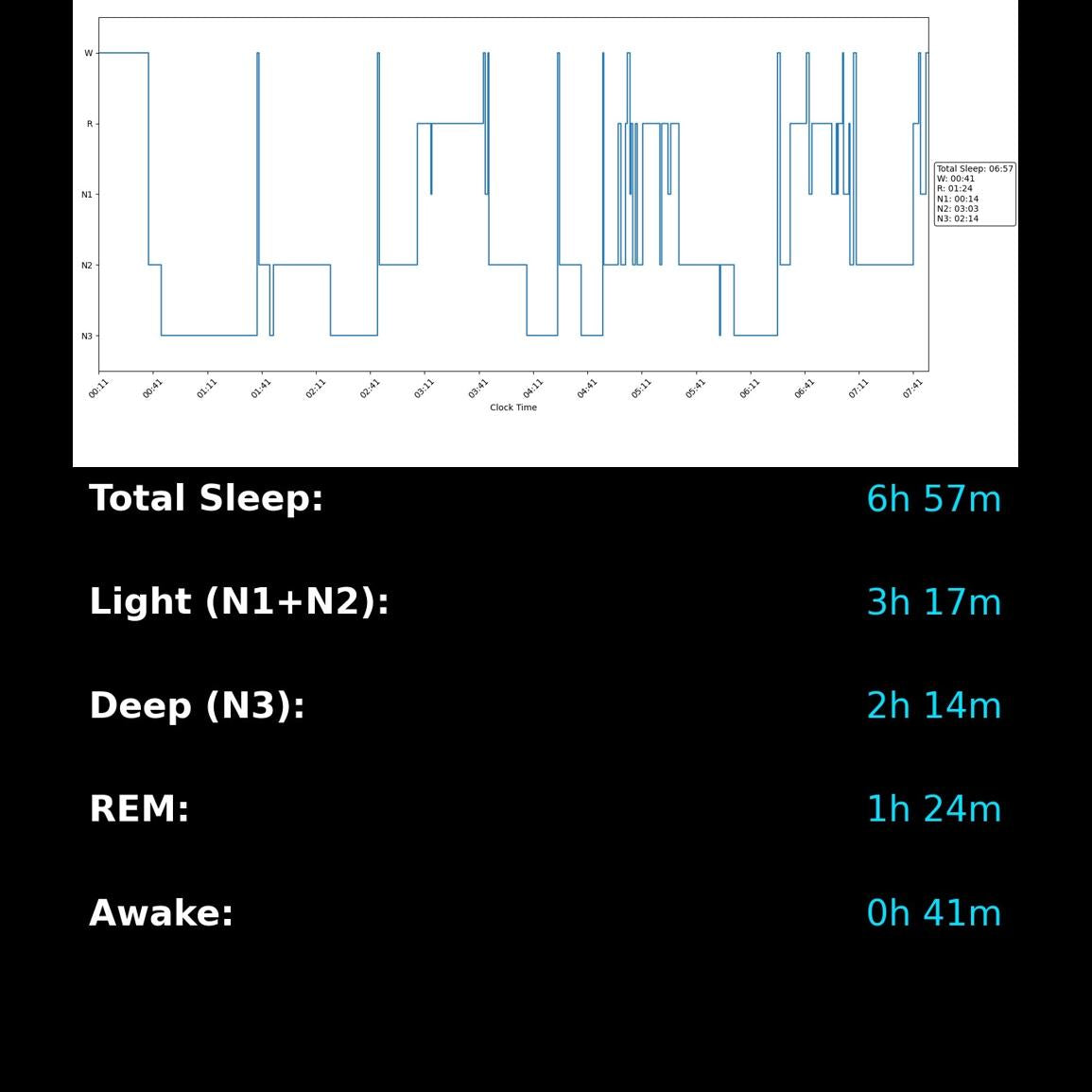 AiON EEG Kit | Brain-Controlled Gaming & Sleep Tracking