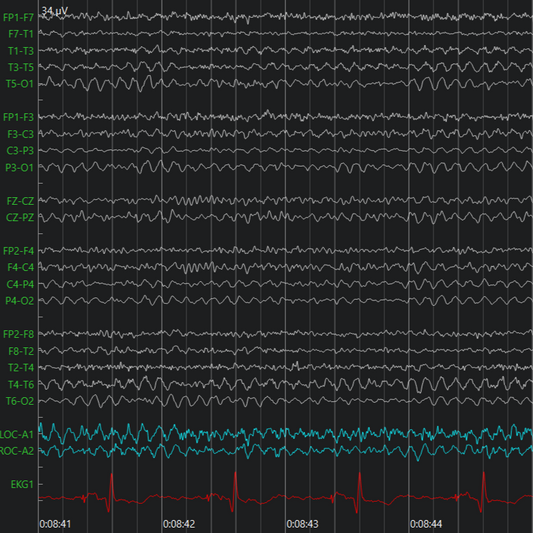 EEG Review Software